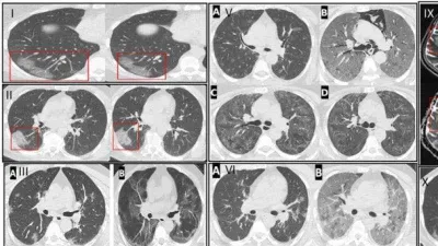 COVID insanlarda nasıl bir hasar bıraktı?