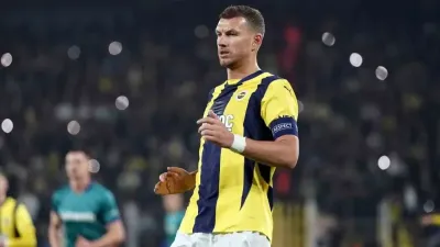 Edin Dzeko’nun elinde kırık tespit edildi