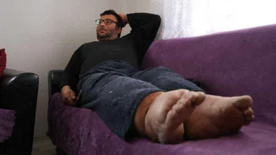 80 santimetre çapına ulaşan bacaklarına çare arıyor