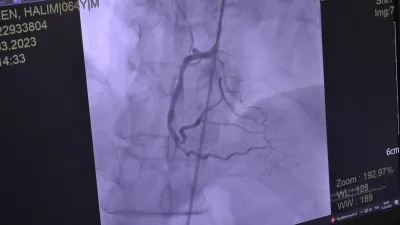 Hipertansiyon Hastalarına ‘Oruç’ Uyarısı