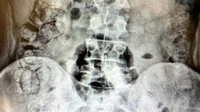 Midede uyuşturucu sevkiyatı