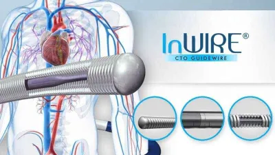 Kalp damarları tam tıkalı da olsa çözümü var