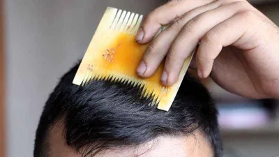 Sivas'ın kemik tarağı tescillendi