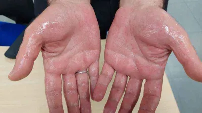 Terlemeye terletmeyen çözüm