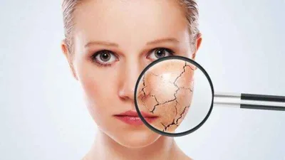 Sıcak havalarda cilt kuruluğu yaşamayın!