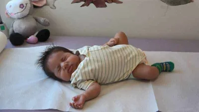 Yemek borusu olmadan doğan bebeğe müdahale