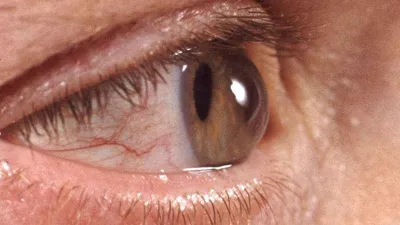 Sonbaharda göz sağlığını korumak için bunlara dikkat!