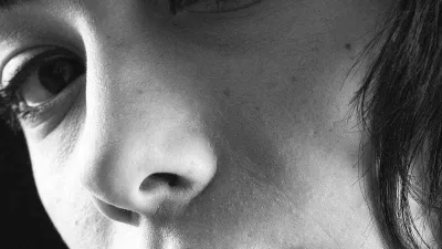 Burun ameliyatı olacaklar, dikkat!