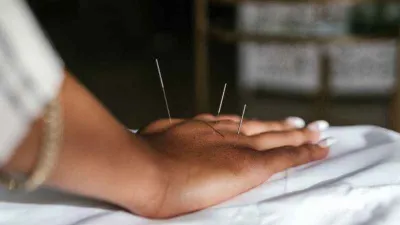 Vücudun gizli eczanesi: Akupunktur
