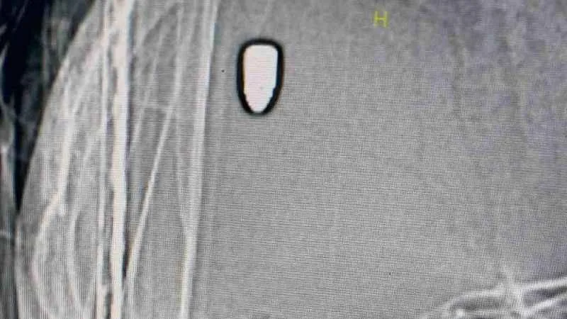 Arkadaşını beklerken kafasına yorgun mermi isabet etti