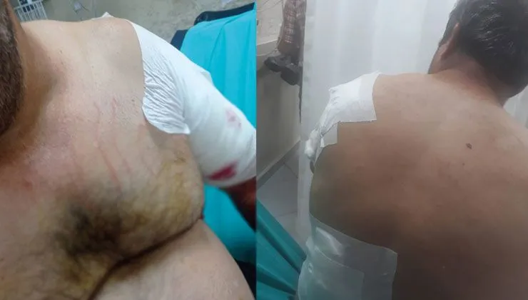 Ayı vatandaşa saldırdı, köylüler korku içinde