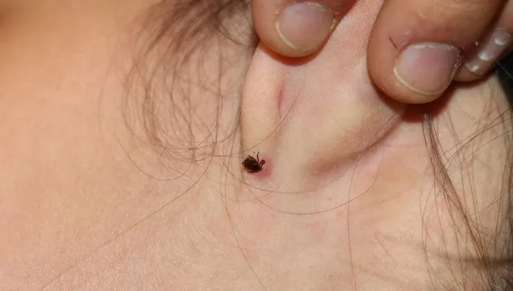 Uzman doktordan kene uyarısı