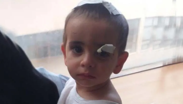 Ağrı’da köpeklerin saldırdığı Ali Asaf Aktekin hayatını kaybetti