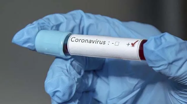 ABD’de Kovid-19 nedeniyle ölenlerin sayısı 473’e ulaştı