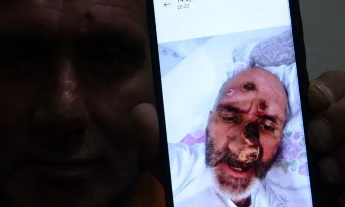 Afrika’dan gelen sineğin, Antalya’da ısırdığı kişinin hayatı karardı