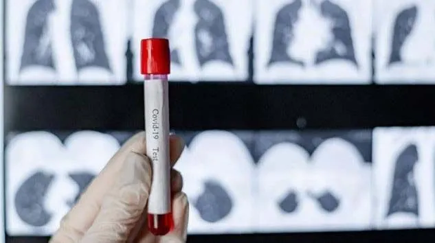 Burdur’da askerlerin Covid-19 testi pozitif çıktı