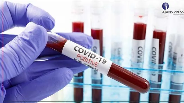 Suudi Arabistan’da son 24 saatte 2 bin 378 vaka