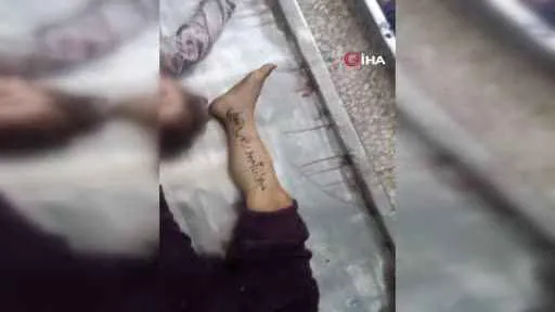 İsrail saldırılarında ölen çocukların isimleri kollarına ve bacaklarına isimlerinden tespit ediliyor