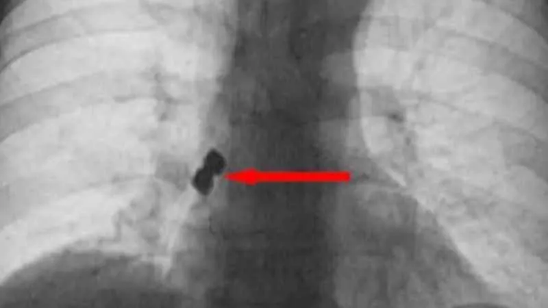 Diş tedavisi için gitti canından oluyordu