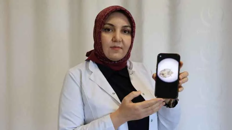 2018 sonrası uyuz vakasında ciddi bir artış var