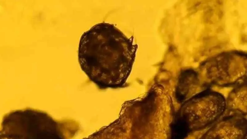 Banyo sonrası şiddetli kaşıntı uyuz işareti olabilir