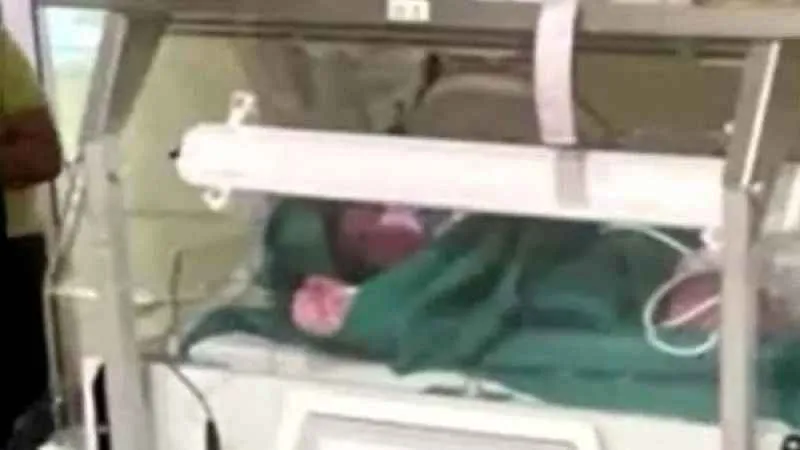 7 kilo 105 gram dünyaya gelen bebek yoğun bakıma alındı