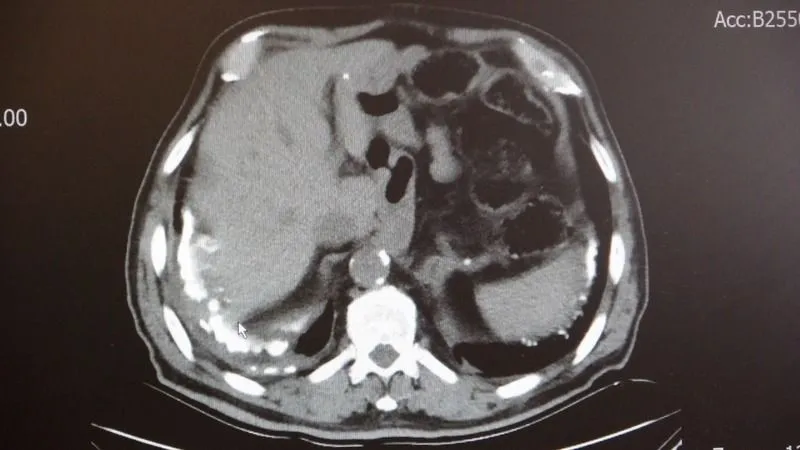 Deprem Bölgesinde ‘Asbest ve Silisyum’ Uyarısı