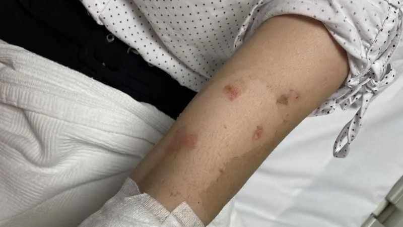 Lavabo açıcı bomba gibi patladı