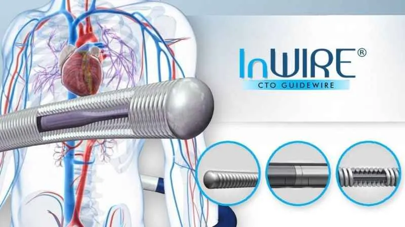 Kalp damarları tam tıkalı da olsa çözümü var