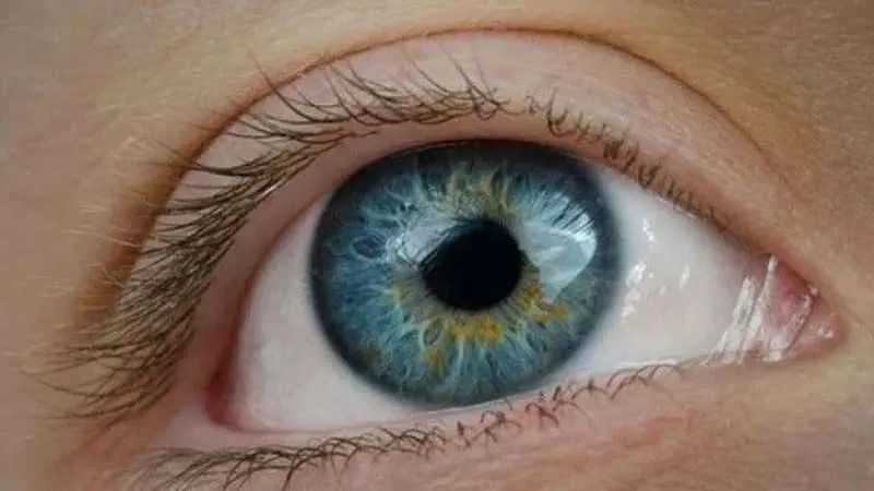 Kataraktı hafife almayın!