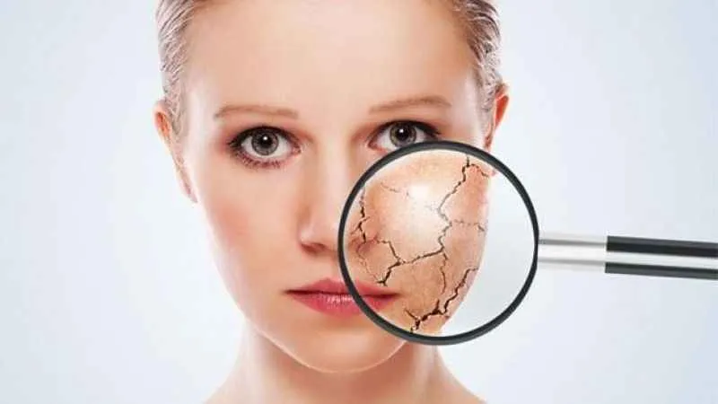 Sıcak havalarda cilt kuruluğu yaşamayın!