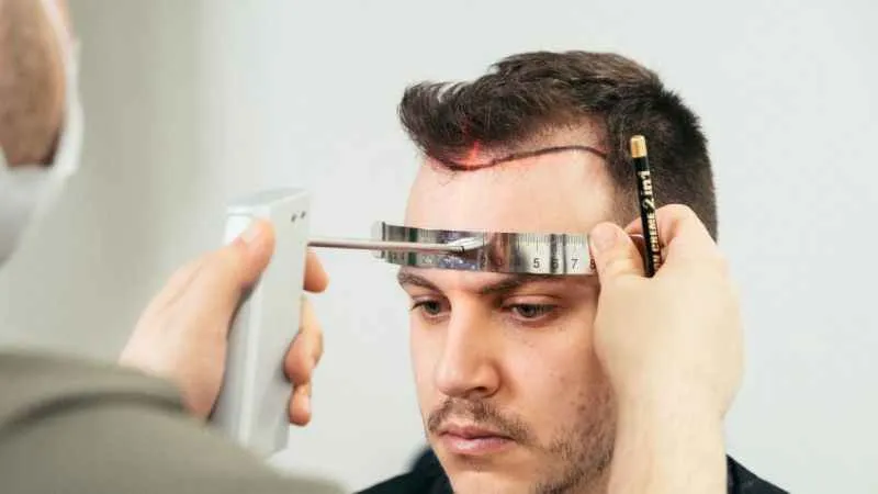 Dünyanın en iyi saç ekim merkezleri İstanbul'da