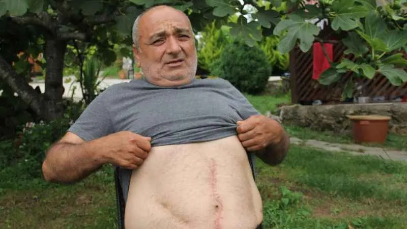 18 yıl boyunca karnındaki gazlı bezle yaşadı