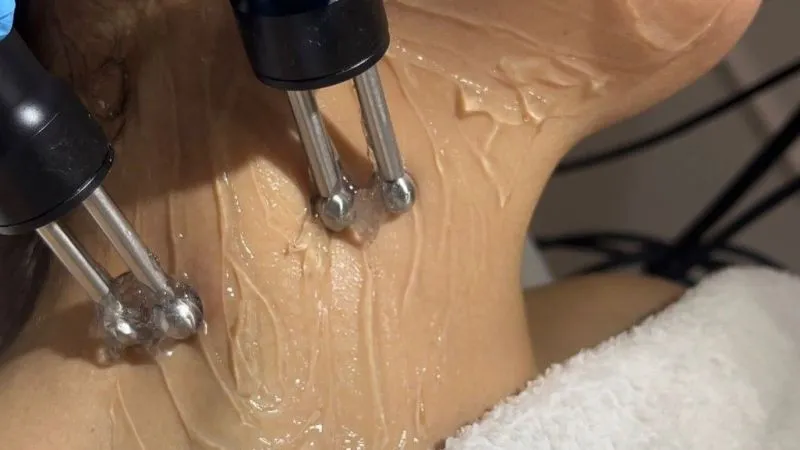 Güzellikte Yeni Trend: Mikro Akım