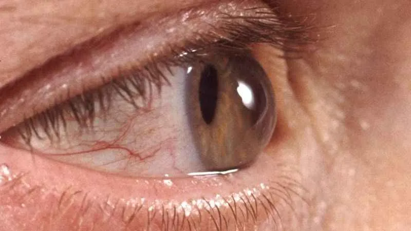 Sonbaharda göz sağlığını korumak için bunlara dikkat!