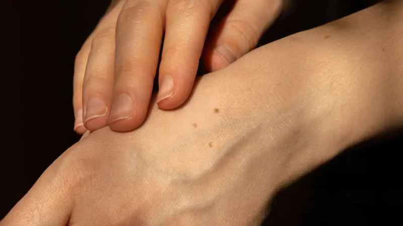 Güneş Işınlarından Korunmak İçin Neler Yapmalı?