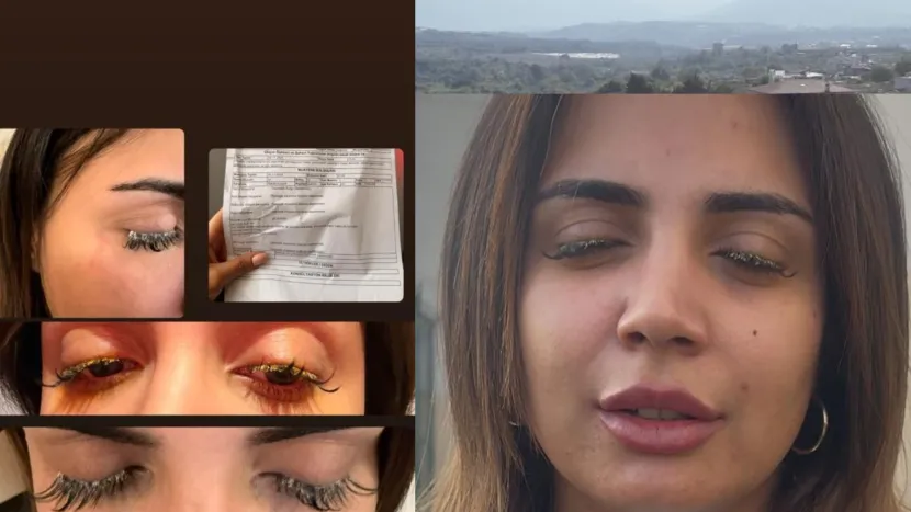 Güzellik merkezinde gözünü kaybediyordu