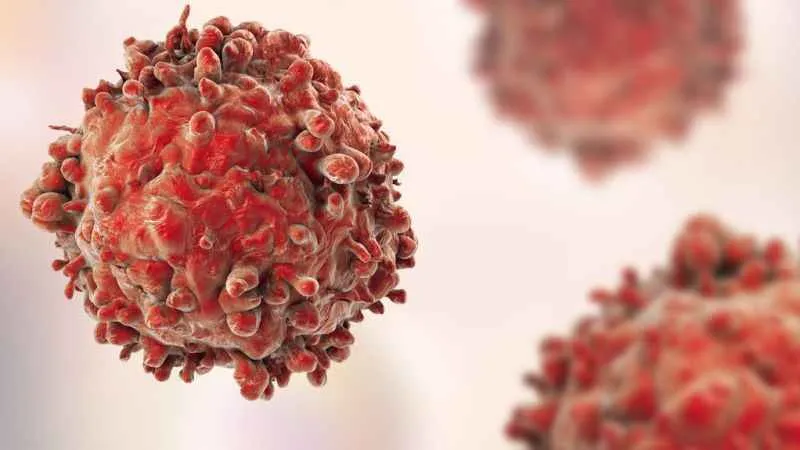 Kanser hücrelerini yüzde 99 yok eden yeni yöntem