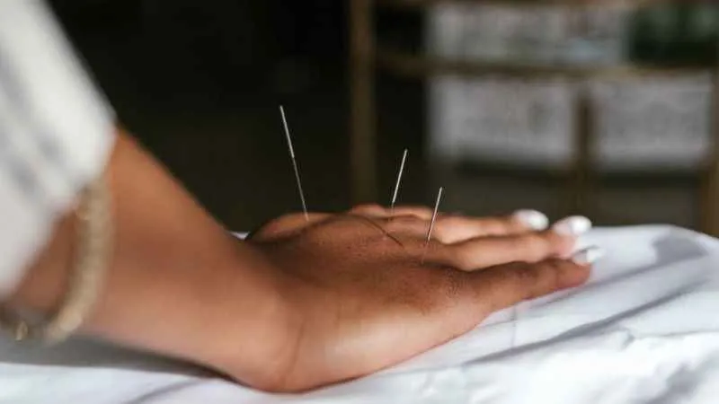 Vücudun gizli eczanesi: Akupunktur