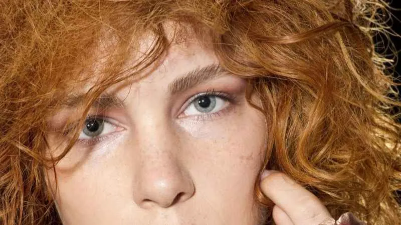 Burun estetiği ameliyatı özgüveni artırıyor