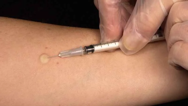 Ciddi bir hastalık olan kızamık aşı ile önlenebilir